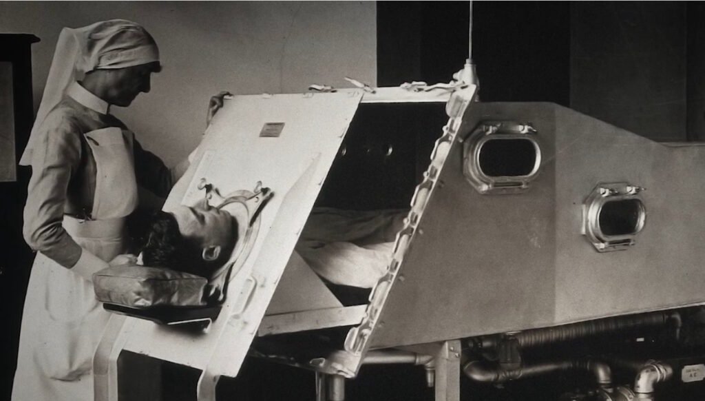 Adolf in partialy open iron lung with nurse standing over him. BW